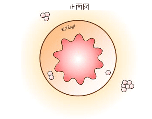 毛巣洞の様子正面