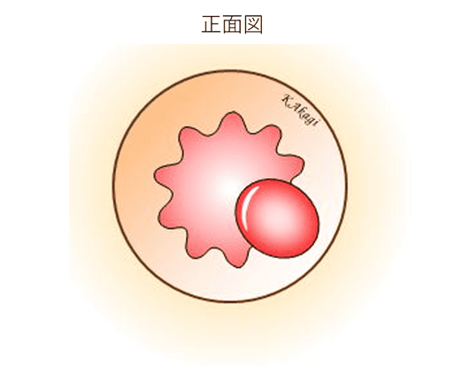 内痔核の様子正面