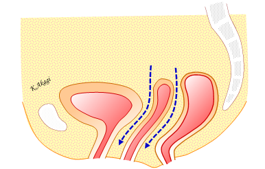 腟や膀胱、直腸周囲を確認するイメージ図